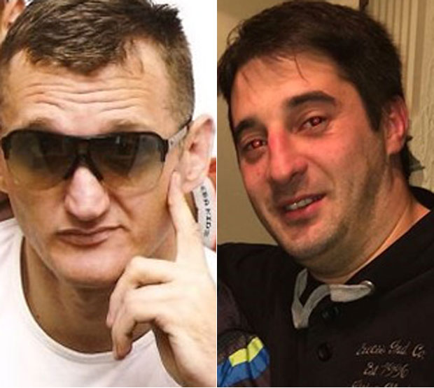 Радоману притвор због сумње да је ранио Маказу